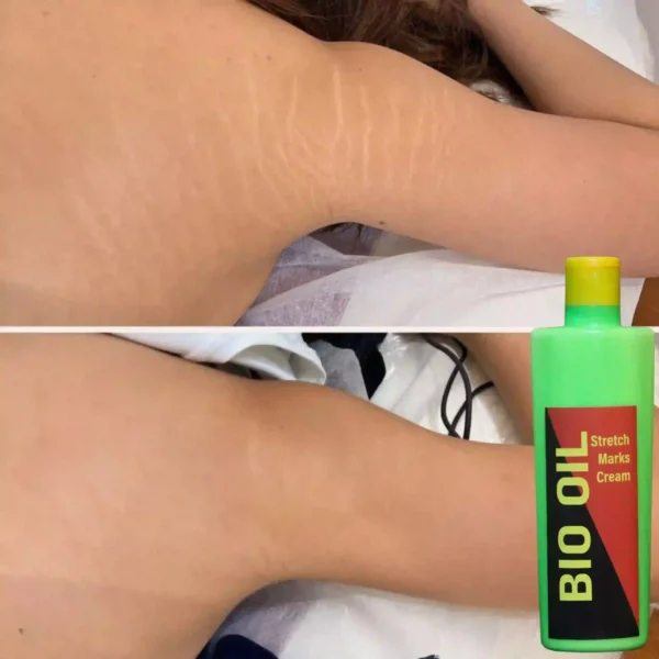 Bio Oil - Image 4