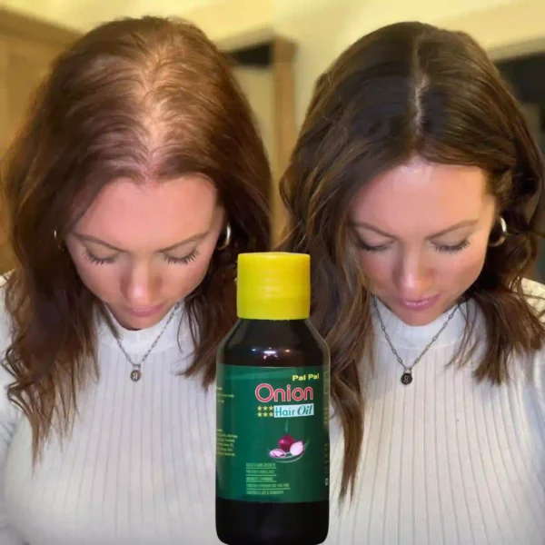 Palpal Onion Hair Oil - Image 2